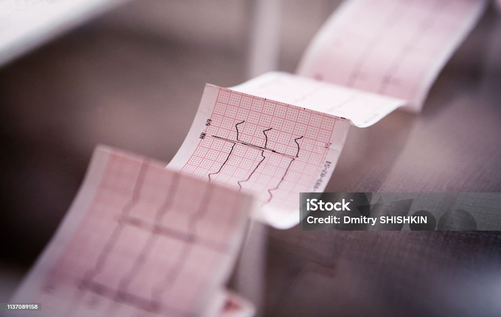 Medical cardiogram printed on paper on the table Medical cardiogram printed on paper on the table, disturbing news about the health of the heart Electrocardiography Stock Photo