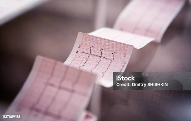 Medical Cardiogram Printed On Paper On The Table Stock Photo - Download Image Now - Electrocardiography, Cardiologist, Heart - Internal Organ
