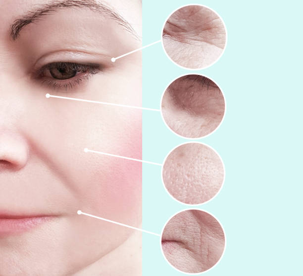 istock woman wrinkles before and after procedures, collage 1137123187