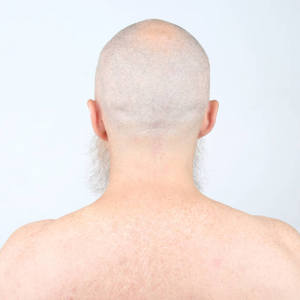 istock portrait of bald man with beard from back on light background 1137149148