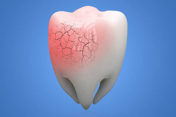 Broken human Tooth on blue background. 3d illustration Broken human Tooth on blue background. 3d illustration. tooth enamel stock pictures, royalty-free photos & images