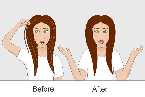 Vector illustration of The girl before and after using the remedy for hair pigmentation