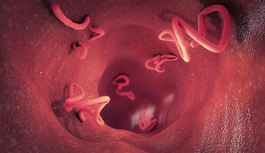 Tapeworm infestation in a human intestine - 3d illustration