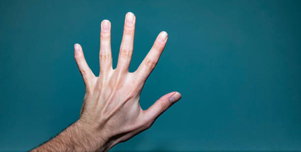 istock Left Hand With Broken Finger And Ganglion Cyst 1137503333
