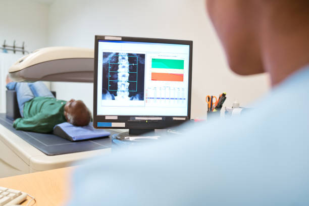 weibliche krankenschwester analysiert röntgenaufnahme auf computermonitor - osteoporose stock-fotos und bilder