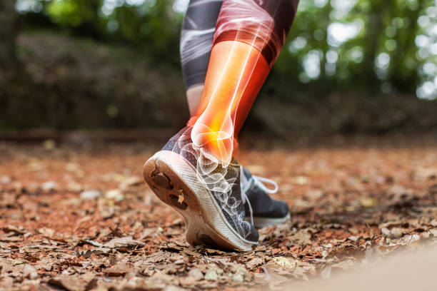 dor do tornozelo em detalhe-conceito dos ferimentos dos esportes - orthopedics - fotografias e filmes do acervo