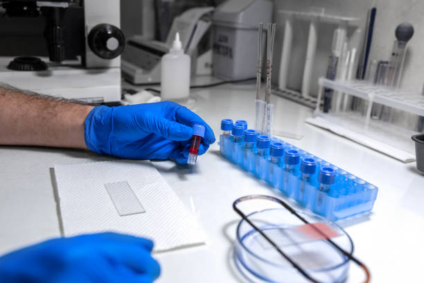 istock scientist prepare blood sample for research on microscope. Placing blood sample on microscope slide 1137583449