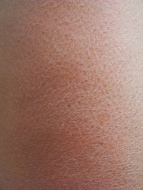istock background rough light skin of a white man without hair 1137773321
