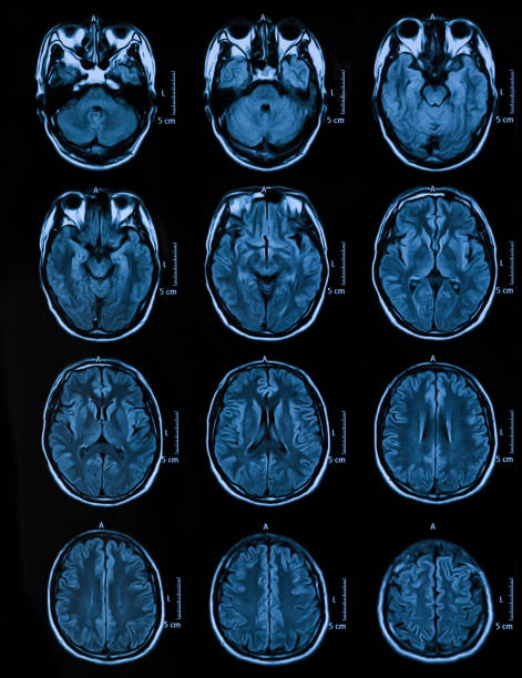 irm scanner tête humaine tomographie - mri scan human nervous system brain medical scan photos et images de collection