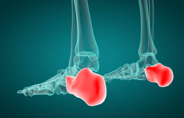 illustrazione 3d della radiografia calcaneus - piede umano foto e immagini stock