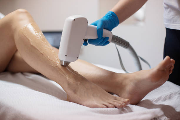 istock Beautician removing hair with laser epilator 1138044459