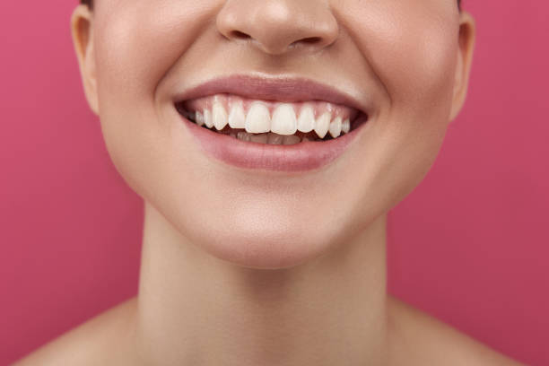 istock Joyful young woman demonstrating her white healthy teeth 1138136625