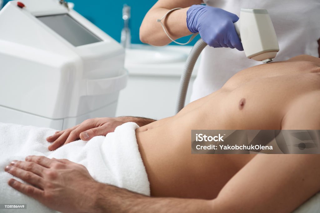 Laser Hair Removal Procedure Of Chest To Man Stock Photo - Download Image  Now - Hair Removal, Males, Men - iStock