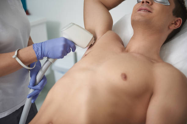 istock Close up IPL epilation procedure of man armpit 1138186451