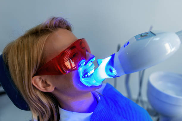 Dentistry dentist working teeth whitening dental medical process Ultraviolet light procedure at dentist office tooth whitening photos stock pictures, royalty-free photos & images