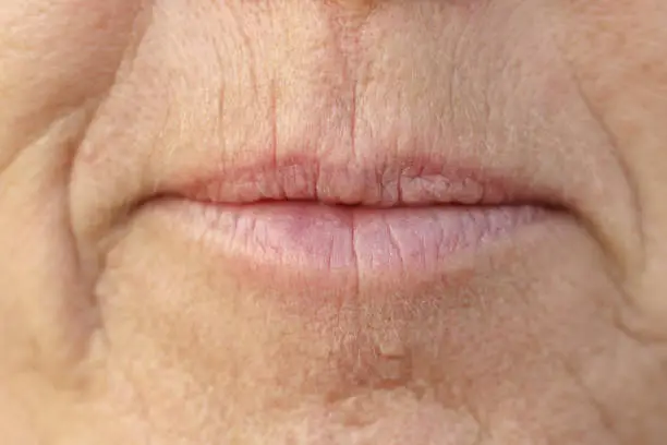 Photo of Extreme Closeup on the mouth of a middle-aged woman