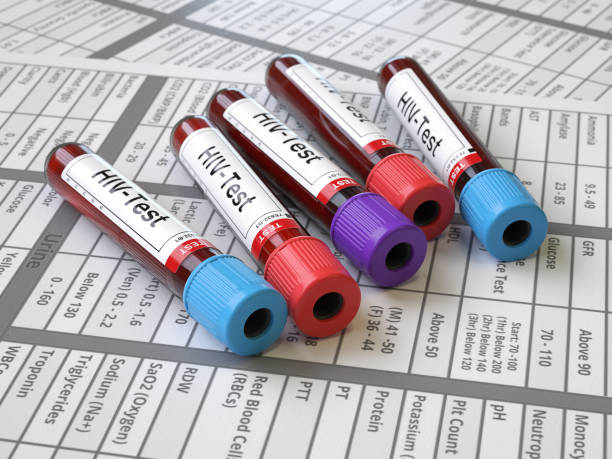 hiv virus test stock photo