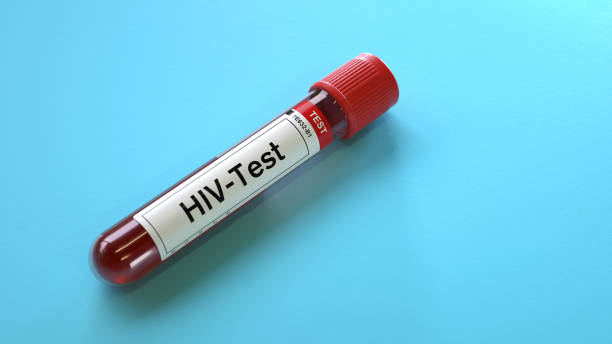 hiv virus test,test tubes stock photo