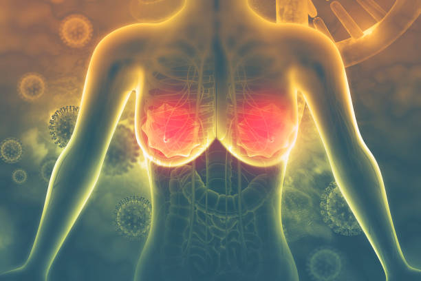 istock Breast cancer. 3d illustration 1138405429