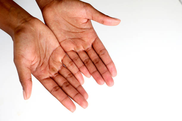 istock two black African hands outstretched, begging, showing 1138408928