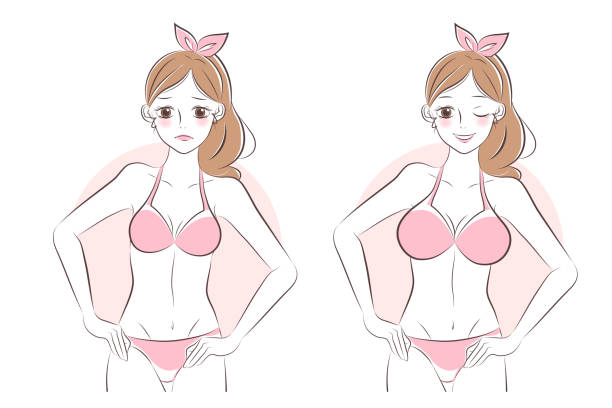 the girl with breast augmentation the girl with breast augmentation - before and after silicone implants stock illustrations