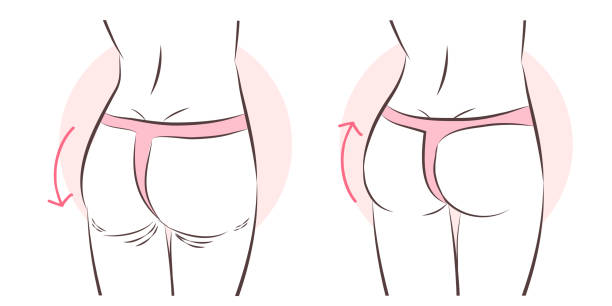 butt implant before and after beauty cartoon woman with butt implant before and after silicone implants stock illustrations