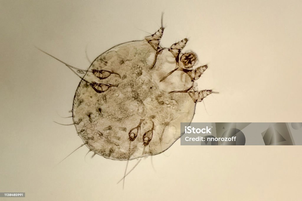itch-mite, parasitic microorganism of human skin itch-mite, parasitic microorganism of human skin, microscope view Parasitic Stock Photo