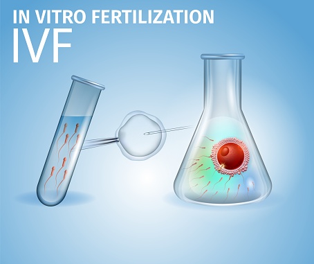 In Vitro Fertilization. Human Fertilized Egg inside of Laboratory Beaker. Needle in Ovum, Sperm in Test Tube. Method of Infertility Treatment IVF Intracytoplasmic. Realistic Vector Illustration Banner
