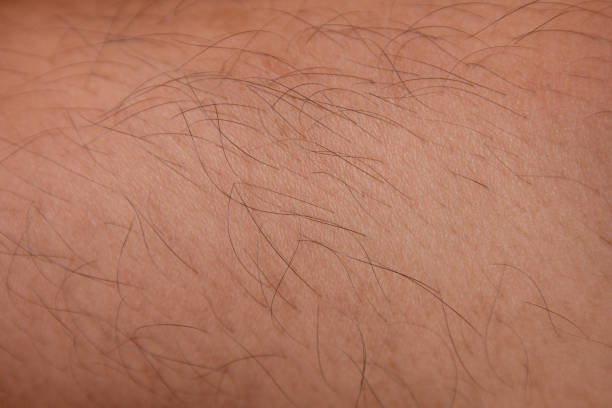 istock hairy leg close up background 1138797450