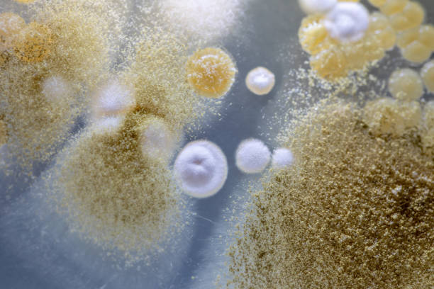 característica de actinomyces, bactérias, levedura e em meios seletivos de amostras de solo para estudo em microbiologia laboratorial. - print media fotos - fotografias e filmes do acervo