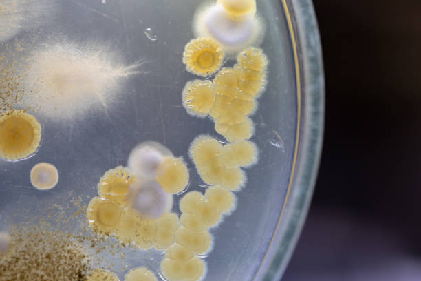istock characteristic of Actinomyces, Bacteria, yeast and Mold on selective media from soil samples for study in laboratory microbiology. 1138843802