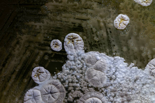 característica de actinomyces, bactérias, levedura e em meios seletivos de amostras de solo para estudo em microbiologia laboratorial. - print media fotos - fotografias e filmes do acervo