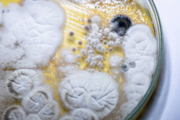 característica de actinomyces, bactérias, levedura e em meios seletivos de amostras de solo para estudo em microbiologia laboratorial. - print media fotos - fotografias e filmes do acervo