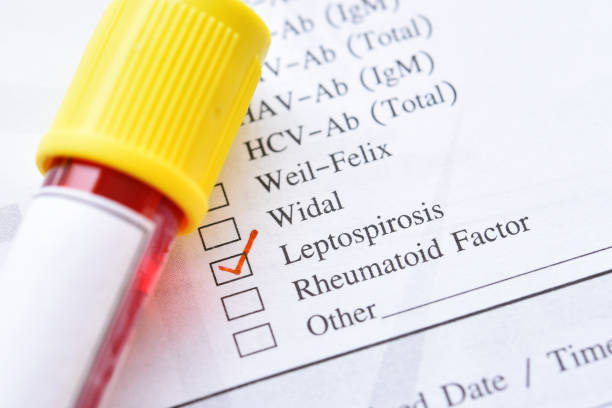 Blood sample for Leptospirosis test Blood sample tube with laboratory requisition form for Leptospirosis test leptospira stock pictures, royalty-free photos & images