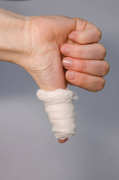 istock a finger in bloody bandage 1138901078