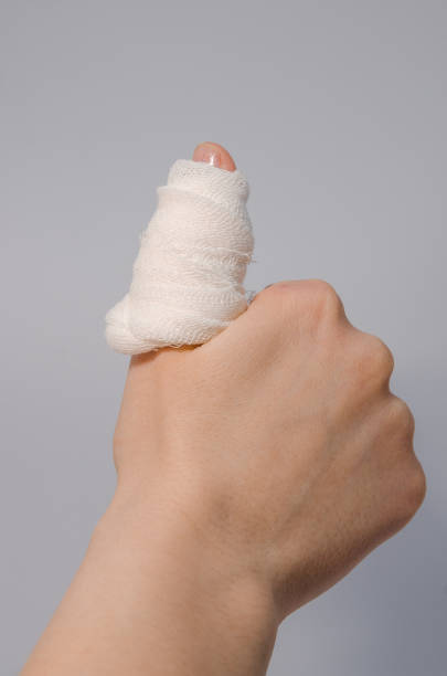 istock a finger in bloody bandage 1138901214