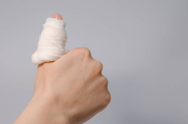 istock a finger in bloody bandage 1138901272