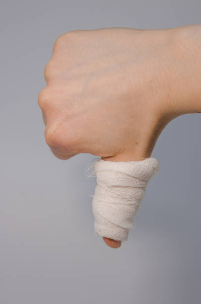 istock a finger in bloody bandage 1138902175