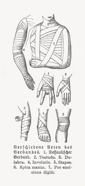 Different types of compression bandages, wood engravings, published in 1897 Different types of compression bandages. Wood engravings, published in 1897. bandage arm stock illustrations