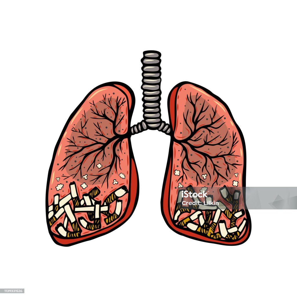 Hand drawn cigarettes in human lungs Hand drawn cigarettes in human lungs. Unhealthy habit smoking concept. Color sketched vector illustration Addict stock vector