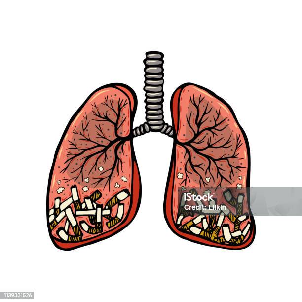Hand Drawn Cigarettes In Human Lungs Stock Illustration - Download Image Now - Addict, Addiction, Anatomy