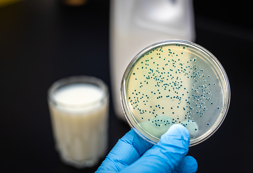 Placa de cultivo de bacterias Brucella aislada de la leche photo