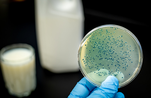 bacterial culture plate holding against glass of milk and bottle of milk