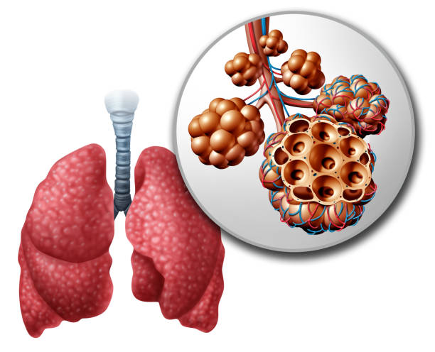 Lung Pulmonari Alveoli Lung pulmonary alveoli or alveolus anatomy diagram as a medical concept of a close up of the human anatomy and respiratory or respiration medicine as a 3D illustration on a white background. alveolus stock pictures, royalty-free photos & images