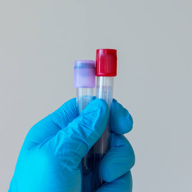 пустые вакуумные трубки для анализа венозной крови в руке врача - doping test стоковые фото и изображения