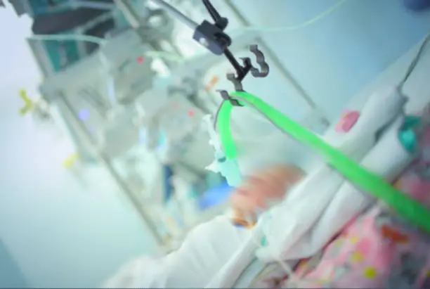 Photo of Newborn baby connected to the life support equipment in the NICU