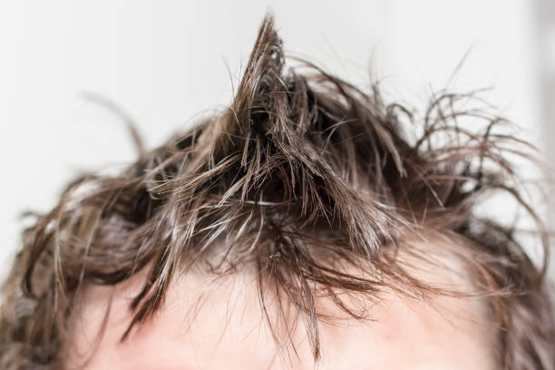 istock Male head with disheveled, unwashed hair on a white background. 1139758515