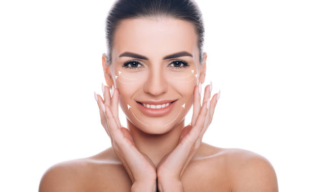 smiling woman with lifting arrows on face. concept of skin lifting - lifting device imagens e fotografias de stock