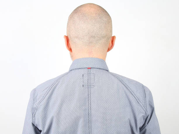 istock portrait of a bald man from the back 1139943017