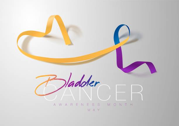 Bladder Cancer Awareness Calligraphy Poster Design. Realistic Marigold And Blue And Purple Ribbon. May is Cancer Awareness Month. Vector Bladder Cancer Awareness Calligraphy Poster Design. Realistic Marigold And Blue And Purple Ribbon. May is Cancer Awareness Month. Vector Illustration bladder cancer stock illustrations